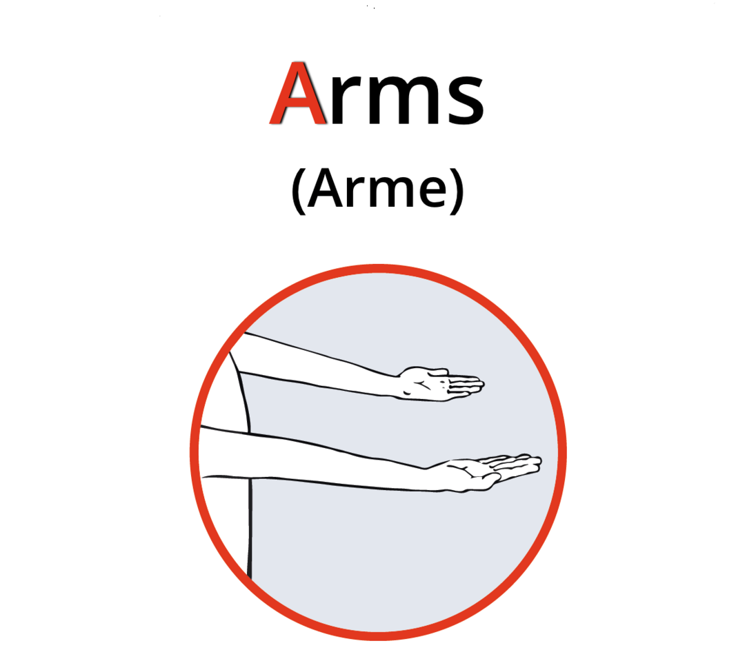 Bitten Sie die Person, die Arme nach vorne zu strecken und dabei die Handflächen nach oben zu drehen. Bei einer Lähmung können nicht beide Arme gehoben werden, ein Arm sinkt oder dreht sich nicht.